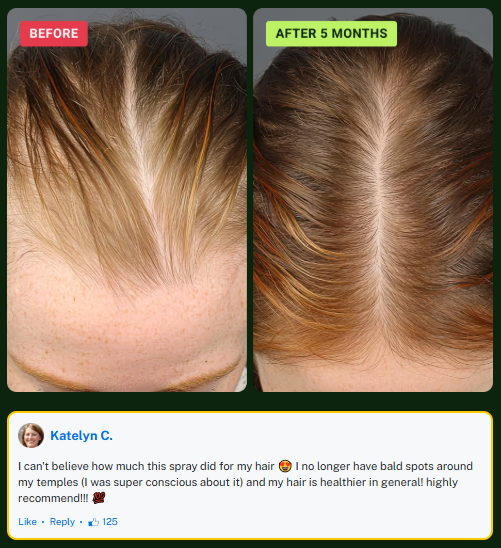 Woman with healthy, thick hair